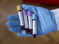 Қазақстанда өткен тәулікте 450 адамнан коронавирус анықталды